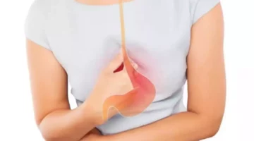 نقص حمض المعدة.. إليك الأسباب وطرق العلاج
