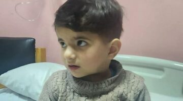 نجاح جراحة قلب مفتوح لطفل من غزة بمستشفى أبو الريش الياباني