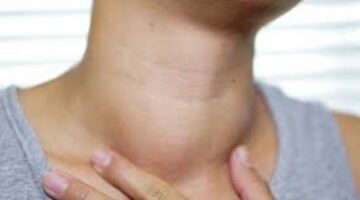 ورم الرقبة قد يكون إشارة لمرض خطير.. تعرف على الأعراض