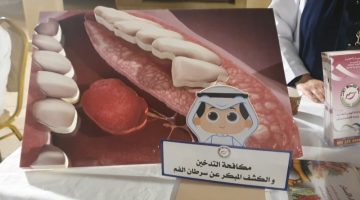 80% نسبة الشفاء من سرطان الفم بالكشف المبكر: أهمية التشخيص والعلاج الفوري