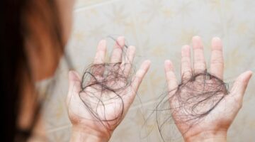 5 فيتامينات مهمة لنمو الشعر.. أنواع يمكنها تقوية البصيلات ومنع التساقط